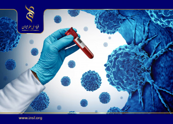 استخراج سریع داده‌های پزشکی در تشخیص سرطان