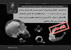 همسان‌سازی فرآیند پرینت همزمان با دو روش روبوکستینگ و FDM به‌منظور افزایش خواص مکانیکی و توان بارگیری پروتزهای شخصی‌سازی شده تهیه شده به روش چاپ‌ سه‌بعدی
