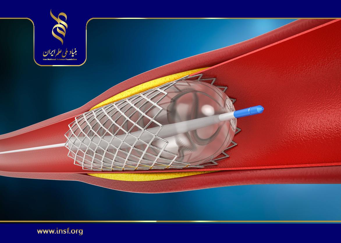 استفاده از استنت با قابلیت کاهش خطر گرفتاری‌های کلینیکی